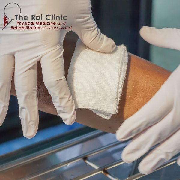 What is debridement