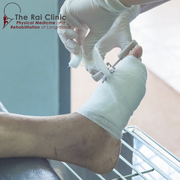 wound care in bay shore pmrli Wound care in bay shore pmrli